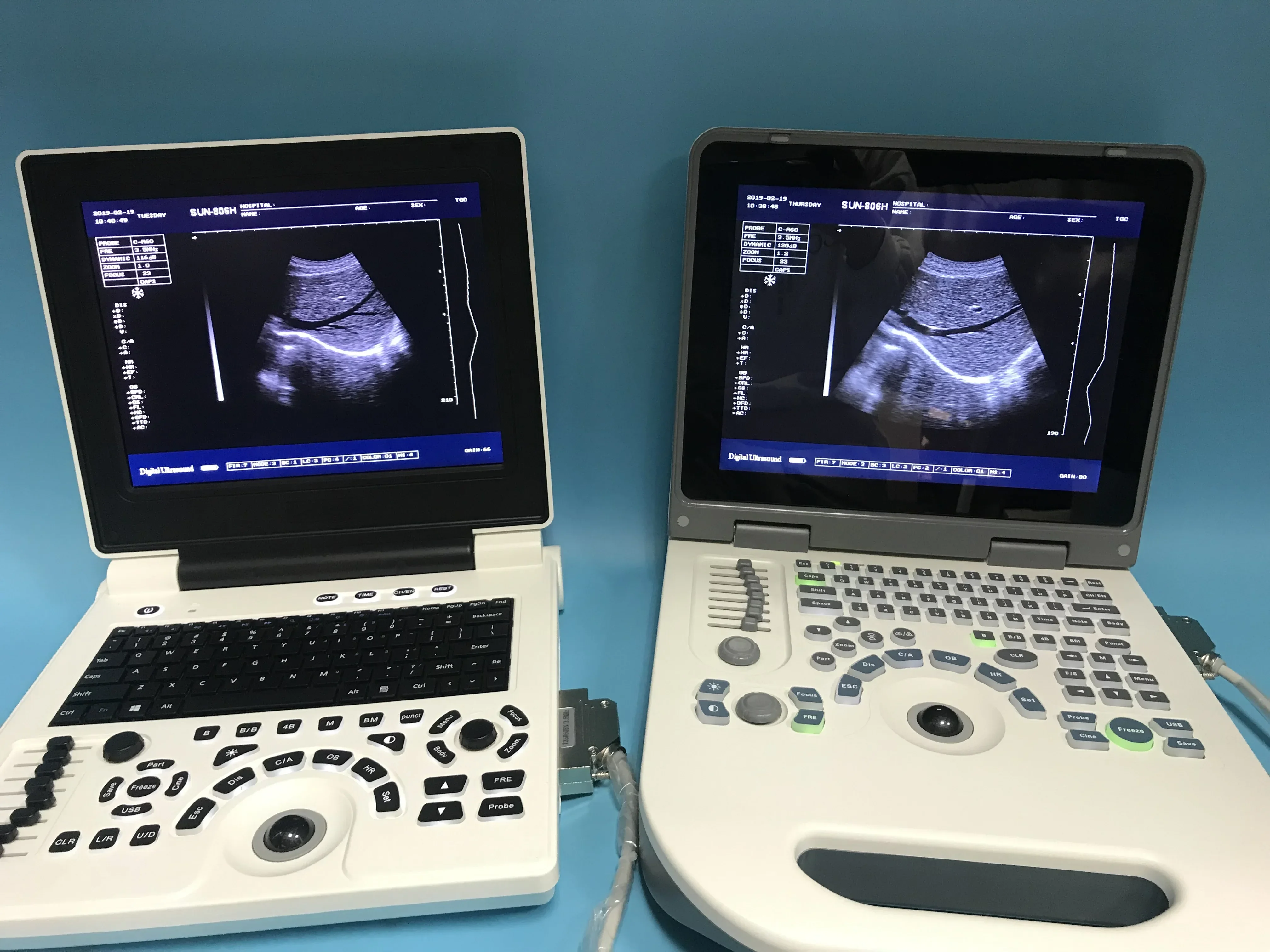 Sunbright Ecograph Laptop 2D Portable ultrasound 12.1\