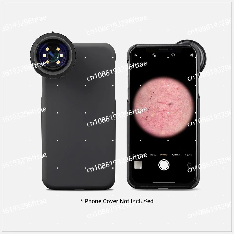 Polarized Skin Dermatolcope Light, Mobile Skin Mirror