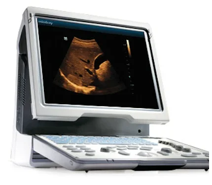 Mindray DP-50 ultrasound machine (with a convex probes)