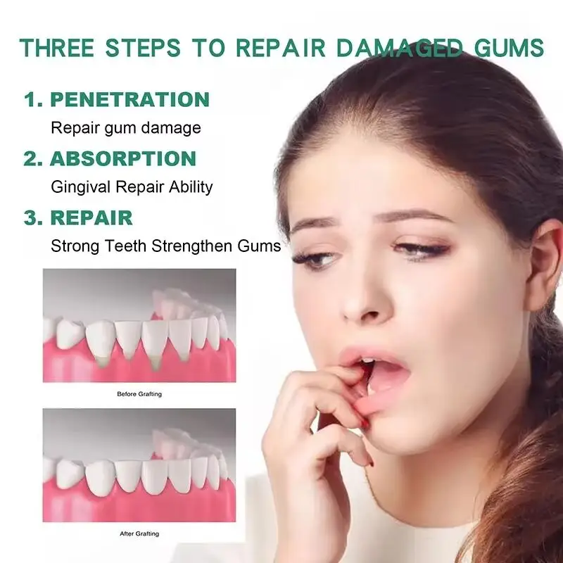 Quickly Repair Gum Serum Effectively Relieve Tooth Allergy Dental Caries Tooth Cleaning Toothpaste Relieve Tooth Damage Drops