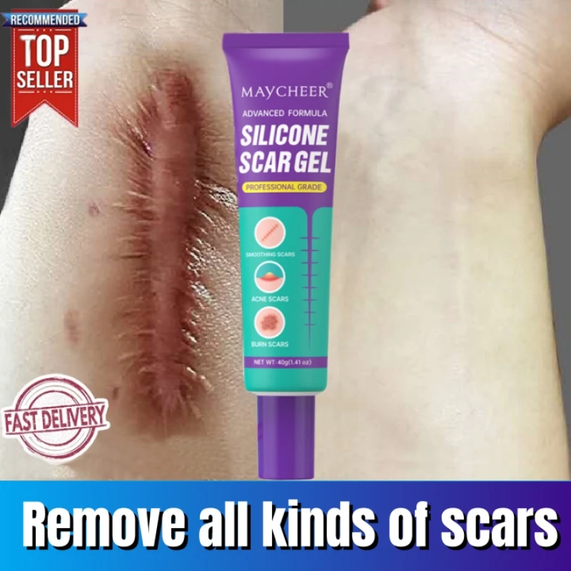 

Natural Scar Healing Cream Fast Fade-out Stretch Marks Burn Surgical Scar Acne Spots Repairing Gel Gentle NonIrritating Product