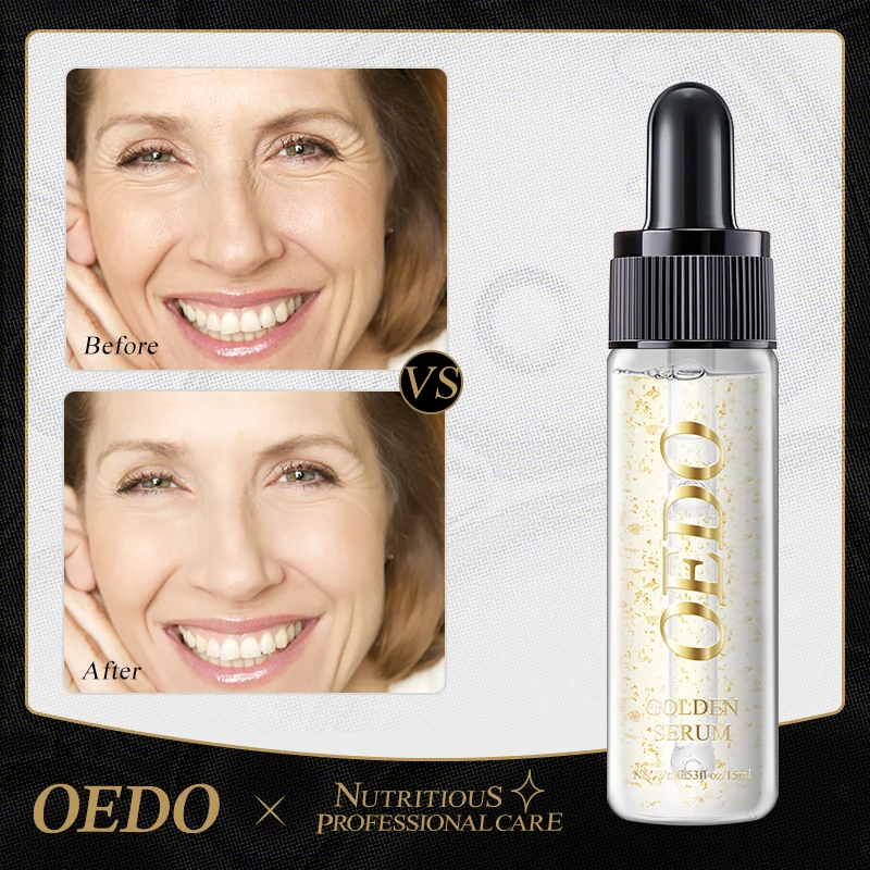 OEDO Gold Serum Anti-Aging Fade linee sottili profondamente nutriente idratante idratante migliora il tono della pelle essenza per il trattamento