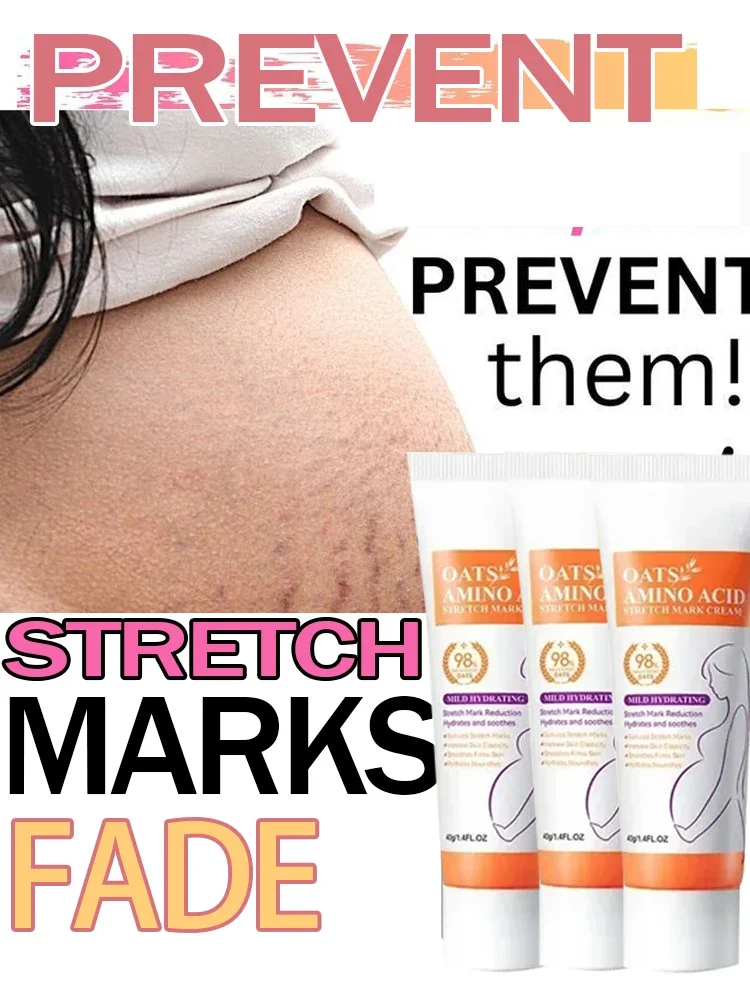 

Stretch Marks Permanent Removal Cream Eliminate Body Belly Stretch Marks Swelling Marks Remove Skin Cracks Repair Firming Care