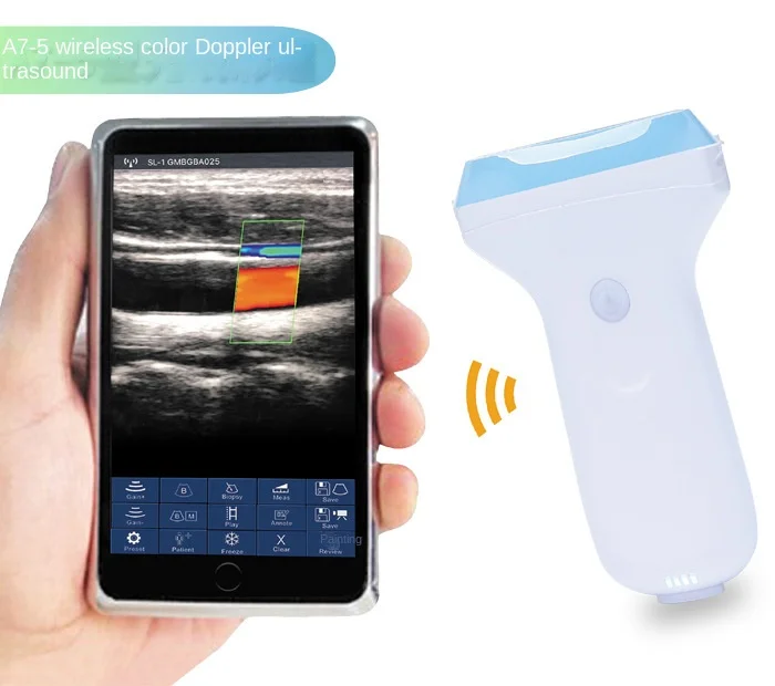 B-Ultrasound Machin…