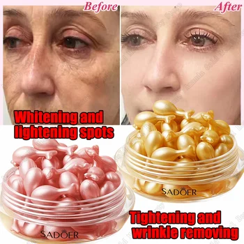 Serum wybielające piegi czarne kropki środek do usuwania melasmy przeciw brązowym plamom rozjaśnij pigmentację nawilżająca pielęgnacja skóry produkty koreańskie