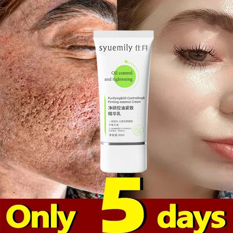 

Removing Large Pores Pore Shrinking Cream Face Tightening Repairing Facial Pore Remover Minimizing Moisturizing Skin Care