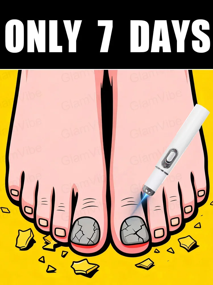 

2025 New Upgraded Version of Blue Laser Nail Fungus Treatment Tool