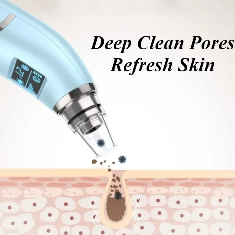 黒ずみ掃除機スキンケア黒ずみ吸い取りツールフェイシャルクレンジング機器家庭用フェイシャル美容機器