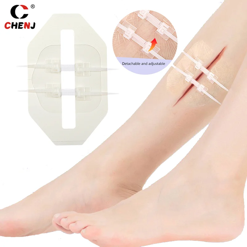 Zipper Tie Wound Closure Patch Zipper Band-Aid Wound Fast Suture Outdoor Portable Hemostatic Patch First Aid Tool