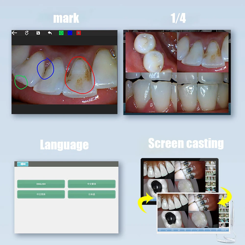 TDOUBUY 4K UHD Dentystyczna Kamera Intraoralna - Wodoodporny Ekran Dotykowy IP67 z Certyfikatem CE dla Klinik Dentystycznych/Chirurgii Ustnej