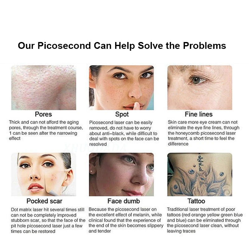 6000 watts2 em 1 808 diodo laser depilação permanente q comutado nd yag portátil máquina de remoção de tatuagem a laser de picossegundo