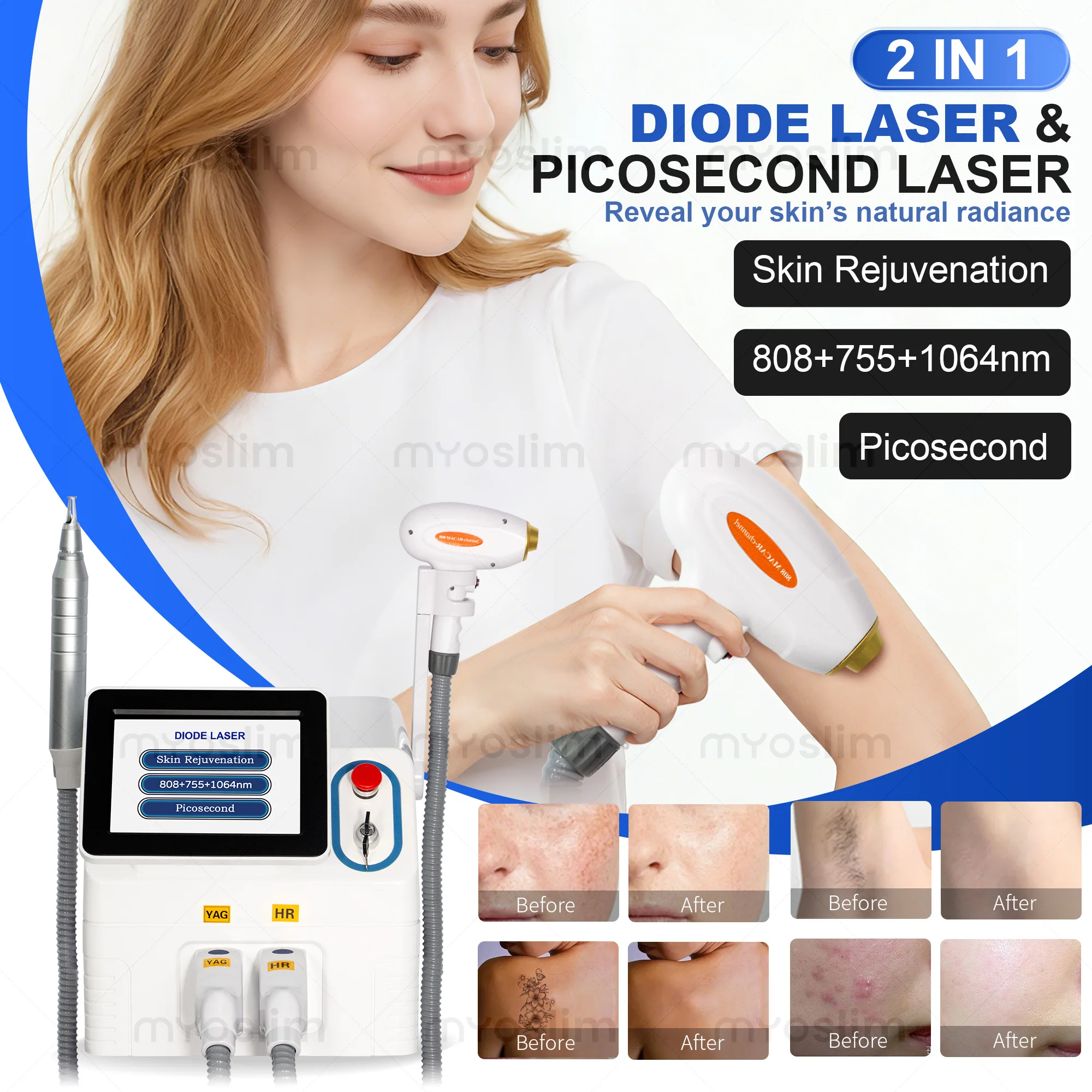 NEW Professional FAC 2 IN 1 Diode  5000W Lase Hair Removal Machine Pico Qswitch ND YAG tattoo removal machine 4 Waves 808NM
