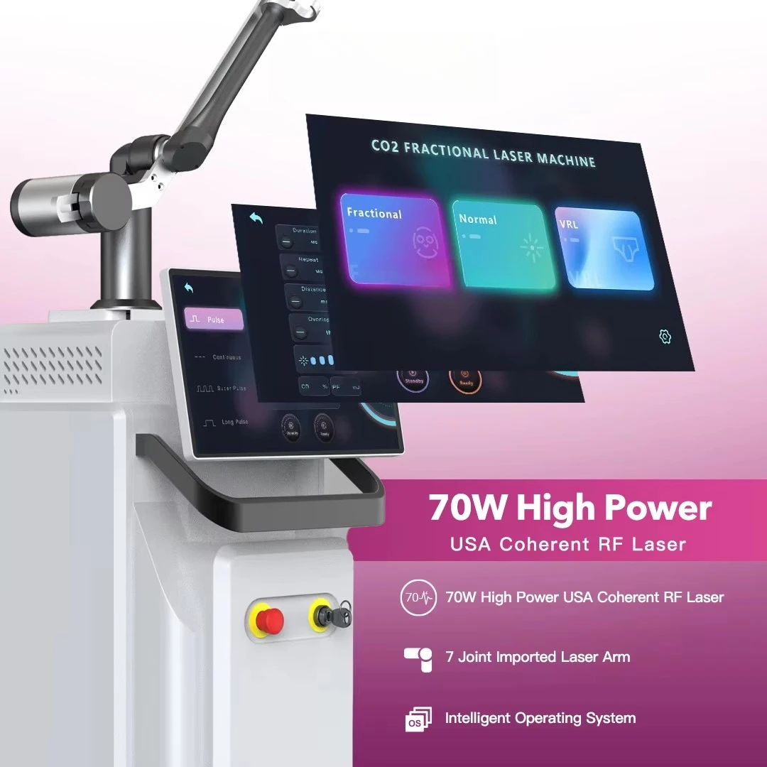 Professional Newangie BMFR15 CO2 Fractional  10600nm Air Cooling 70W/100W Power for Vaginal Surgery Scar Removal Burn/Scald