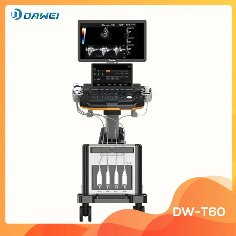 Factory HD trolley color doppler 4d cardiac general ultrasound