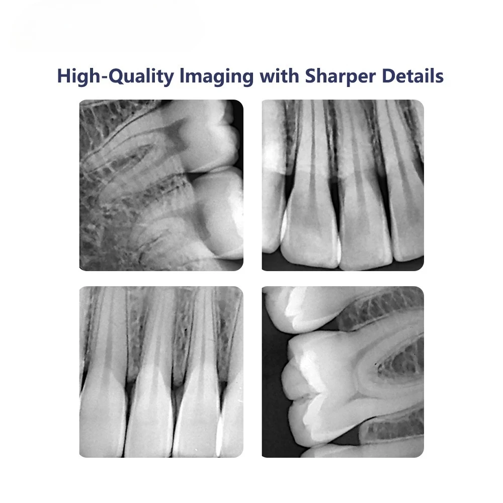 SYJH Dental Digital Sensor Ultra-thin Fast Transmission RVG X Ray Sensor IP68 Grade 3m Cable Imaging System Dentist Equipment