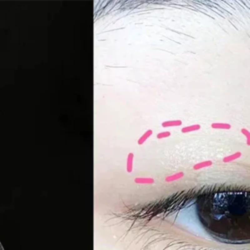 Natural Eye-Lift Mesh-Lace Transparent Invisible Self-adhesive Eyelid Tapes Stickers Women Invisible Double-fold Eyelid Stickers