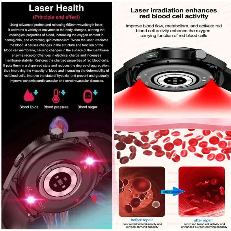 2024 nuovo trattamento Laser tre High Smart Watch Men frequenza cardiaca zucchero nel sangue acido urico Health Tracker SmartWatch per Huawei Xiaomi