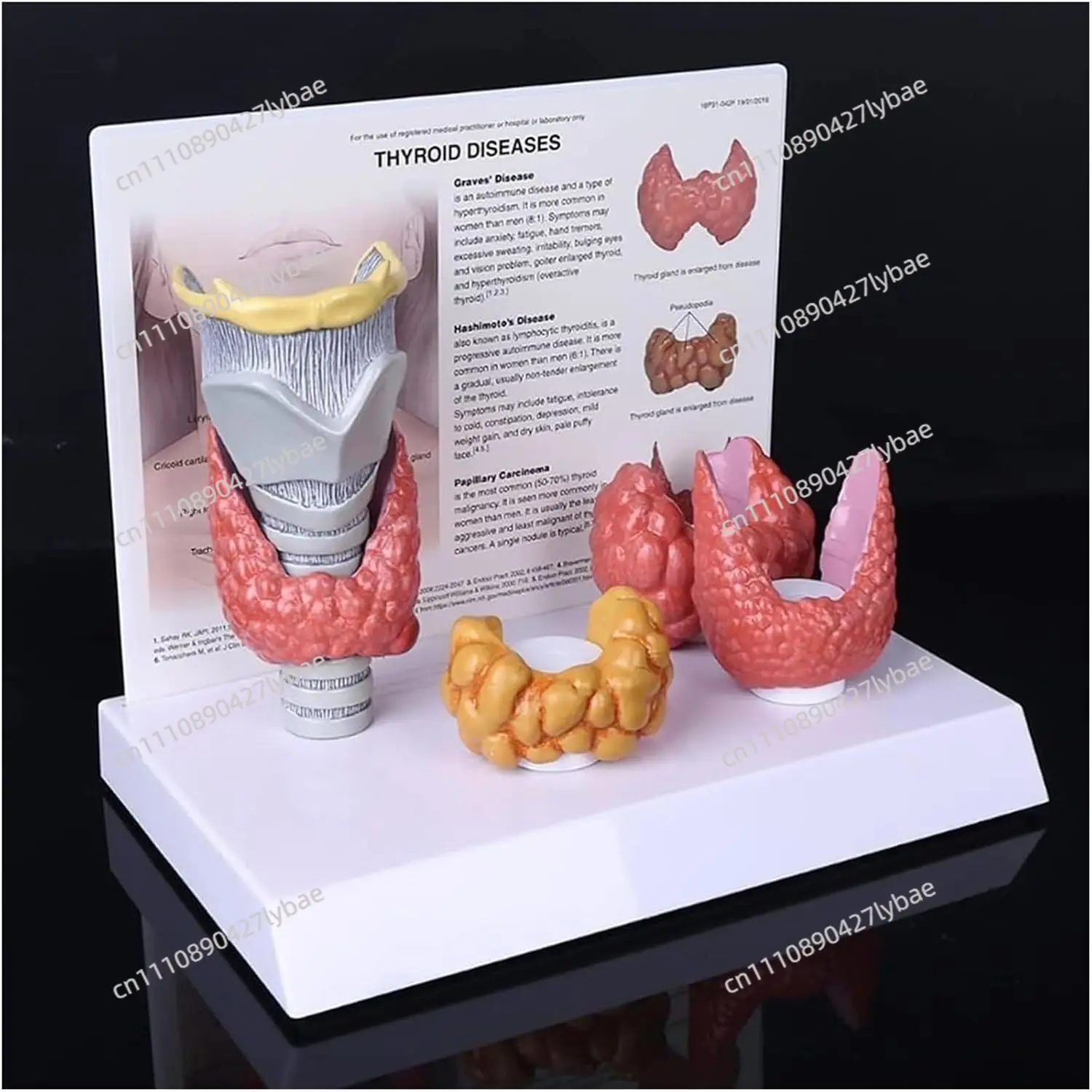 4pcs Set of Human Thyroid Pathological Anatomical Models with Replica Models of Throat and Thyroid Gland and Explanatory Cards