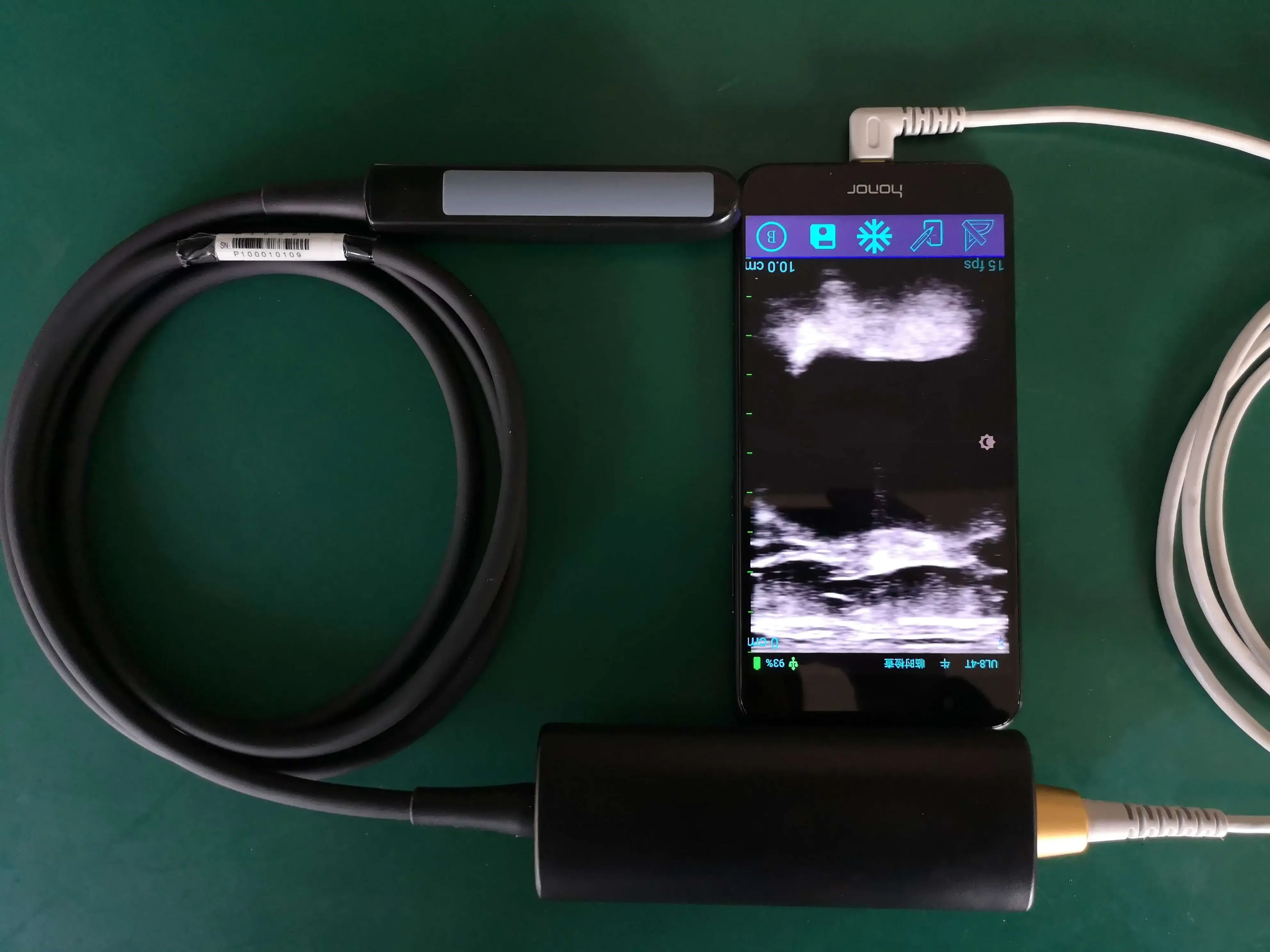 Convenient Cell phone wireless ultrasound probe veterinary usg machine ultrasound pet