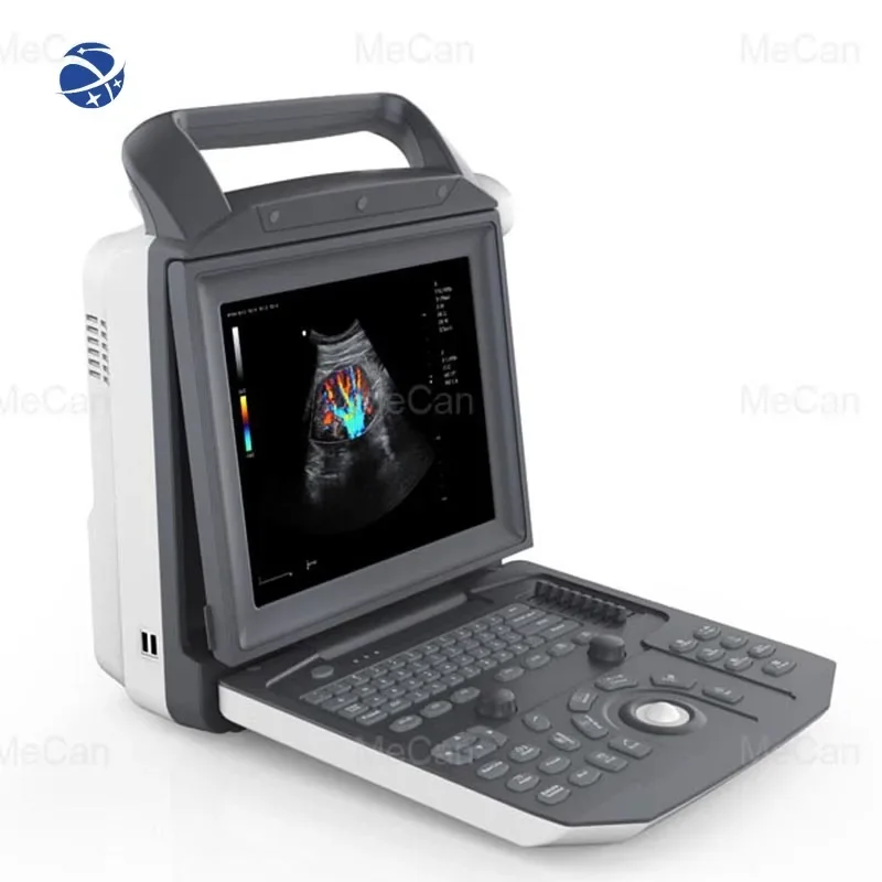 

Medical Ecografo Echo Portable 3D Color Doppler Ultrasound Echocardiography Machine Portable Ultrasound Scanner for Human Being