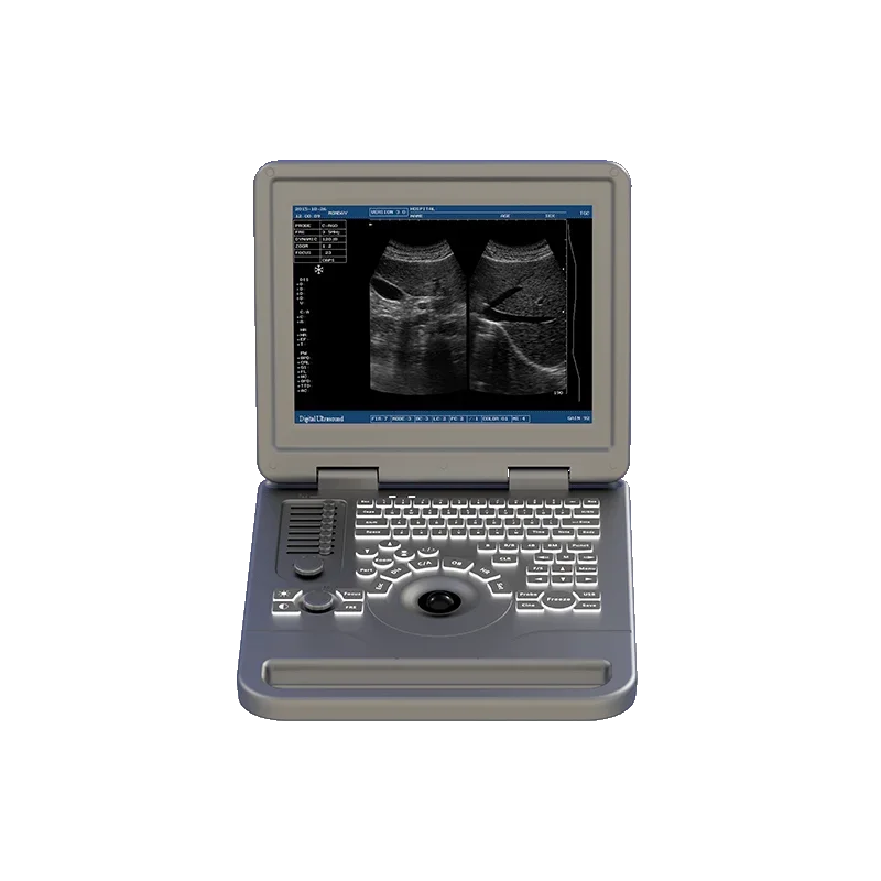 Handheld high-performance all-digital black-and-white veterinary diagnostic ultrasound machine for health monitoring