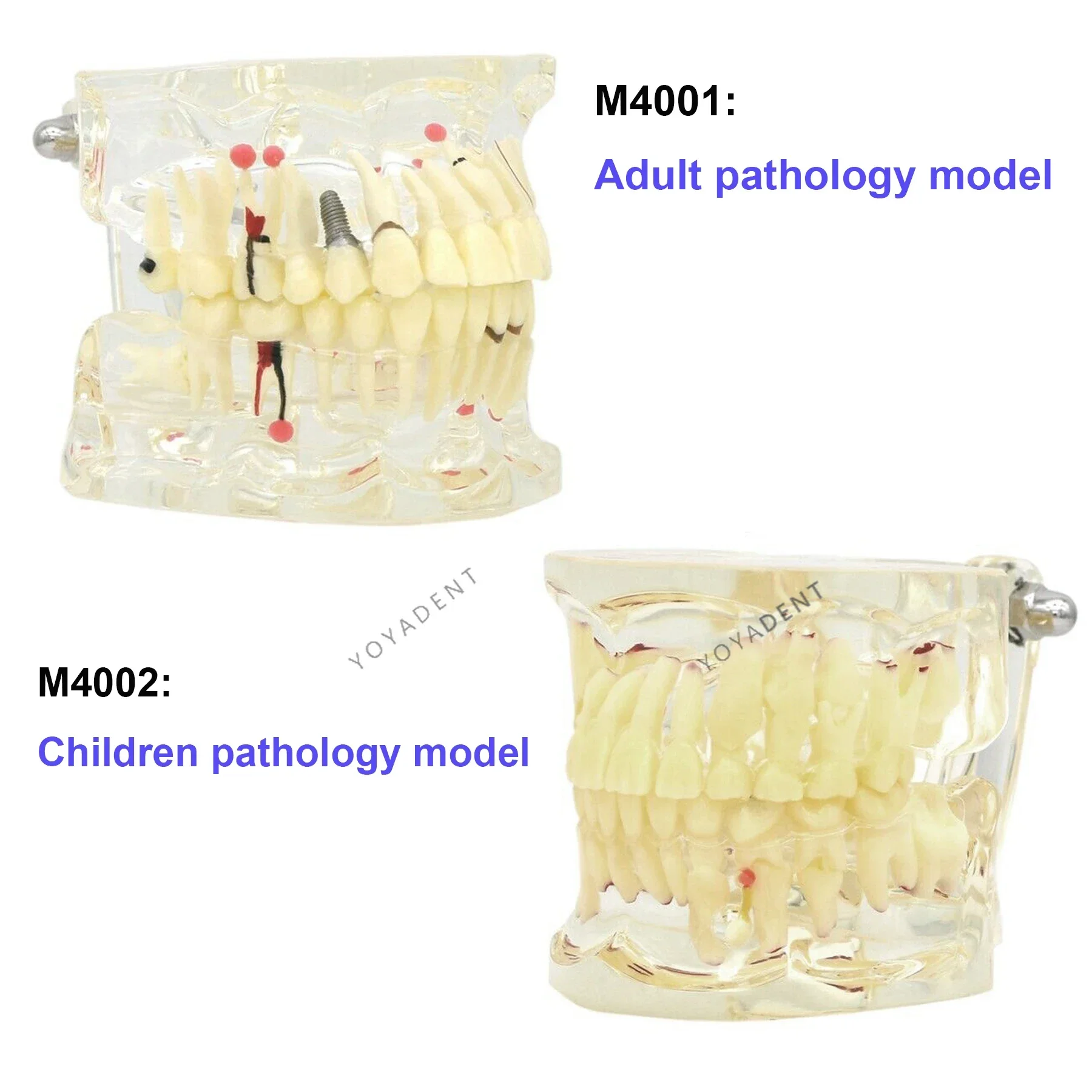 

Dental Model Pathological Teeth Model with Adult and Children Tooth Dismountable Models for Dentist Teaching Studying Demo