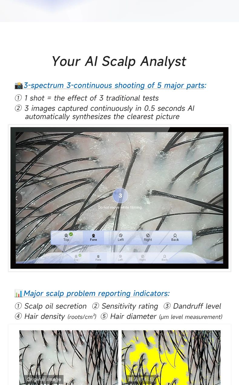 Meiboyi 2025 Analizzatore integrato del cuoio capelluto con schermo a specchio AI di alta qualità può reportare la macchina per l'analisi dei follicoli piliferi portatile HD