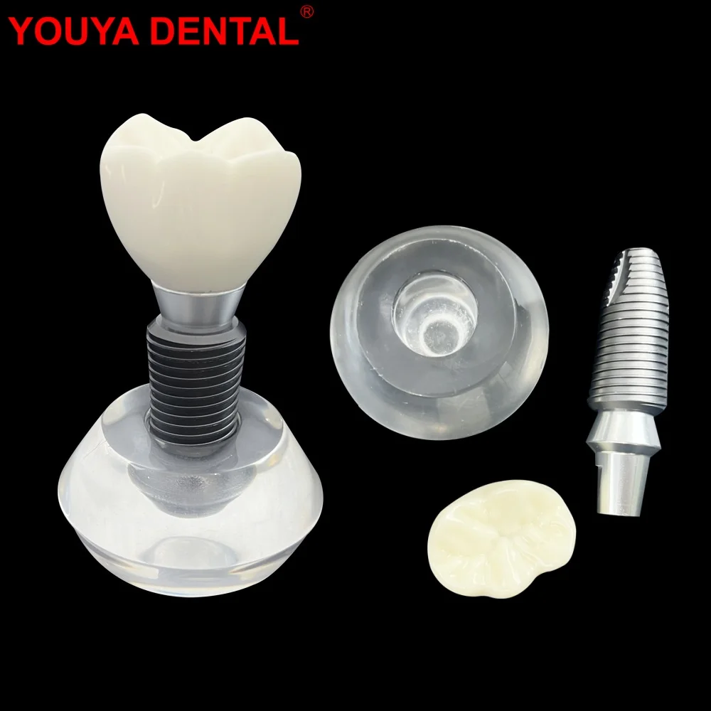 Dental Implant Teeth Model Clear Implant Denture Model Crystal Crown Typodont Structure For Teaching Studying Practice Training