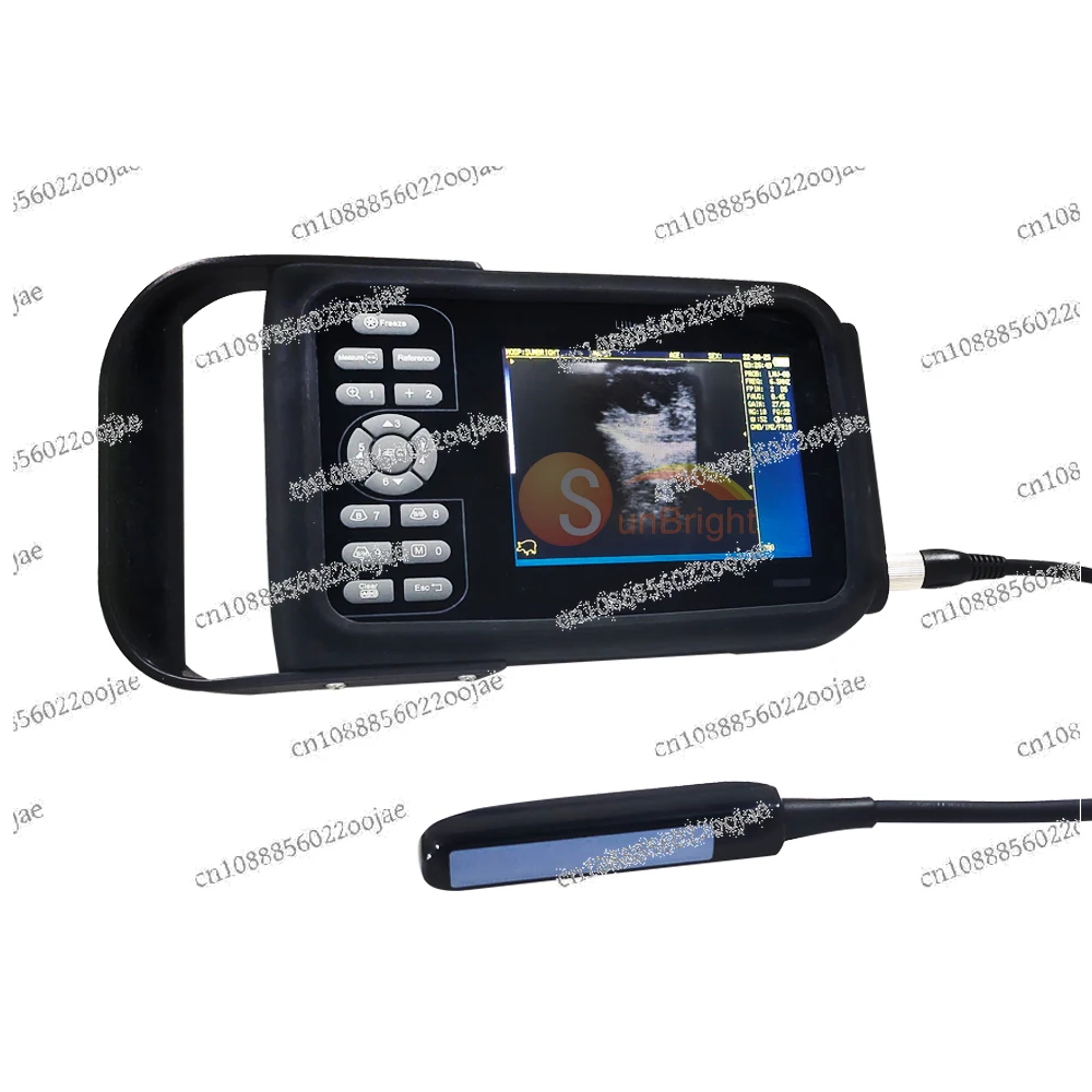 

Hot selling SUN-808F handheld micro ultrasonic machine