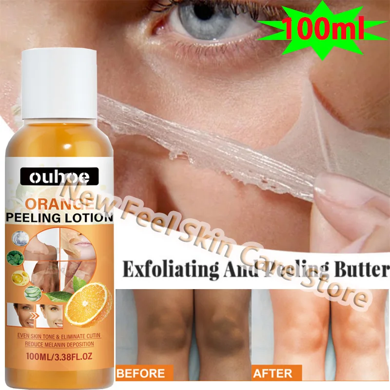 

100ml /200ml/300ml Yellow Peeling Lotion Oil Bleaching Dark Knuckles Skin Exfoliating Whitening Nourishing Whitening Cosmetics
