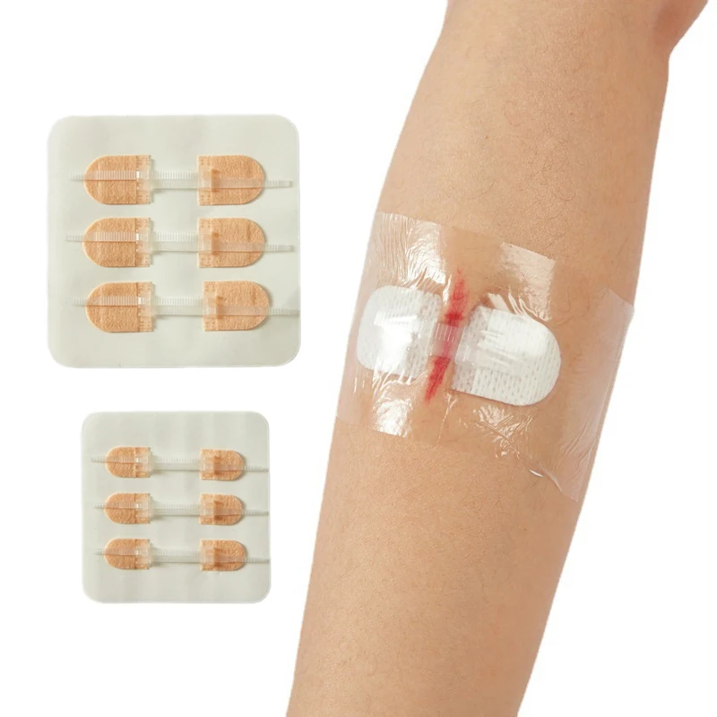 

3Pcs Zipper Tie Wound Closure Patch Hemostatic Patch Wound Fast Suture Zipper Band-Aid Outdoor Portable Skin Care