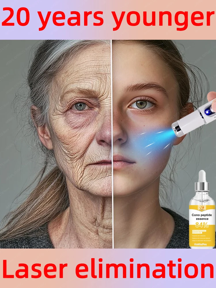 

Laser wrinkle repair