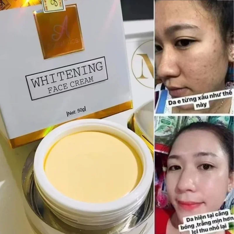 Kem Face Phap Tri Nam Tan Nhang Ngan Ngua Mun Tham Whitening Brightening Skin Care Cream 50ml