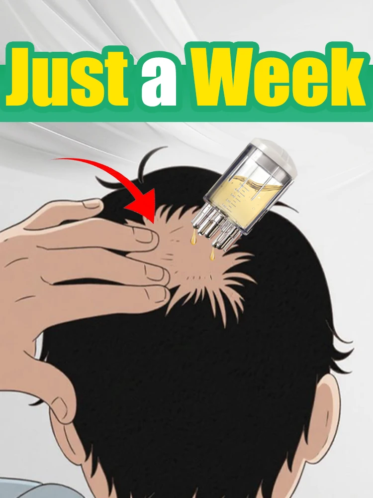 مشط سائل جديد لضبط فروة الرأس لعلاج فروة الرأس، مدلك توجيه سائل، تطبيق زيت مصل نمو الشعر.