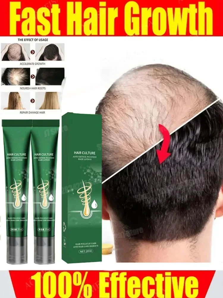 Óleo essencial de crescimento rápido do cabelo promotor óleo seborréico hereditário para perda de cabelo