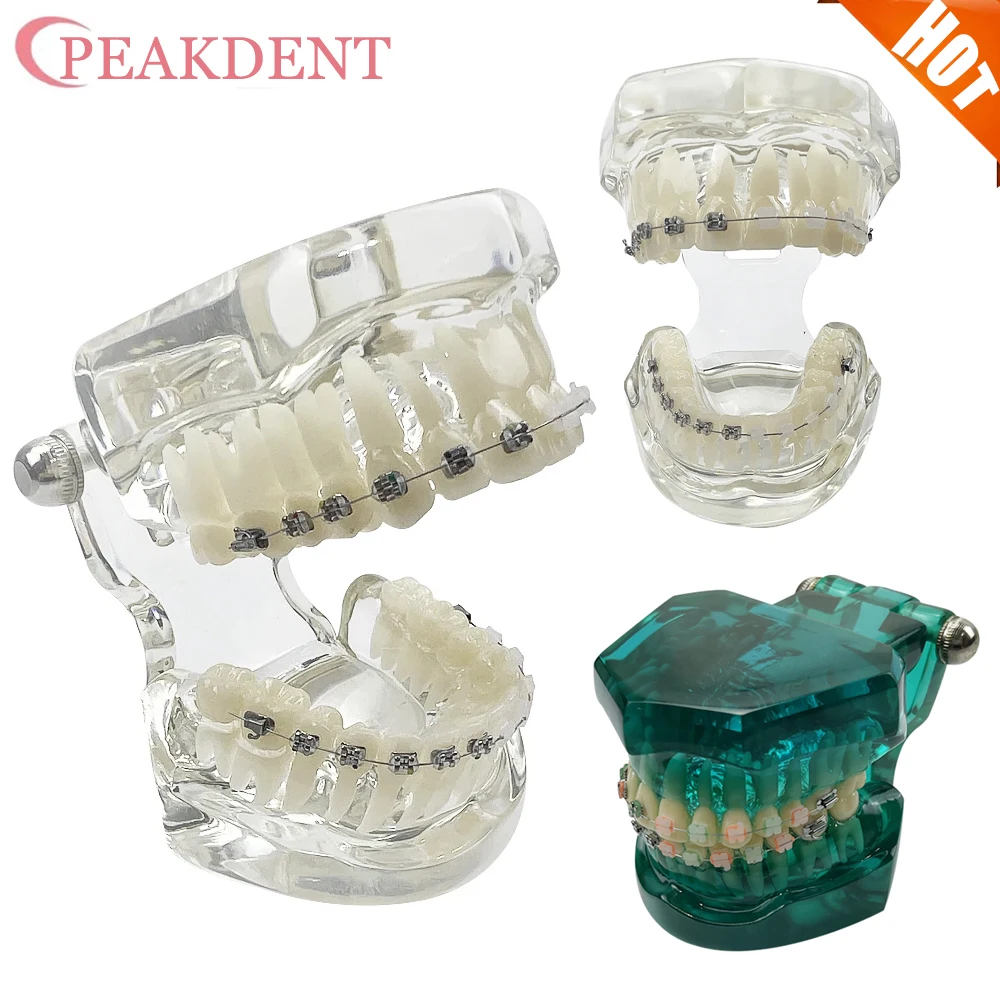 

Orthodontic Implant Gum Tooth Models Metal Ceramic Braces Resin Dentistry Dentist Material Teaching Model For Studying Teaching