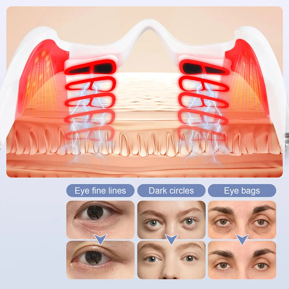 Dispositif de Massage des yeux, soins oculaires, Lifting, raffermissement des cernes, élimination des poches oculaires