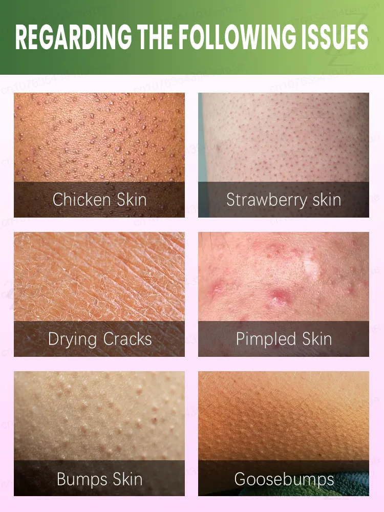 مجرد لمسة خفيفة يمكنها إزالة الميلانين وجعل بشرةك أكثر بياضًا