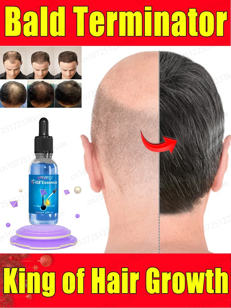 The best hair growth essential oil in February, the most effective product in 2025, repairs various hair loss problems and activ