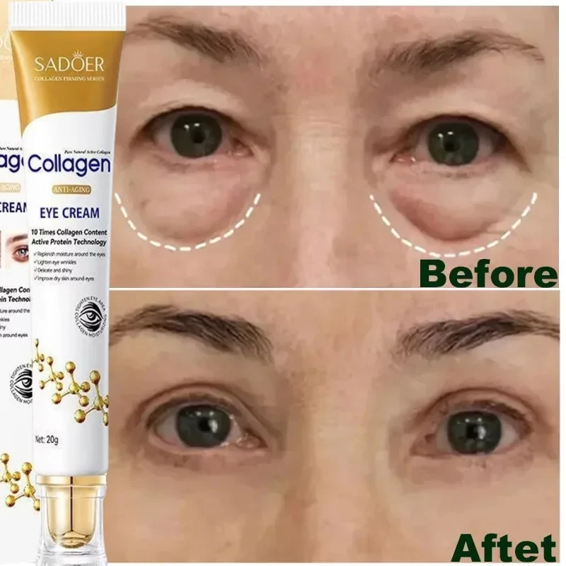 Eye Wrinkle Removal Cream Collagen Fine Lines Firming Skin Anti Dark Circle Puffiness Eye Care Instant Anti-wrinkle Fade Cream