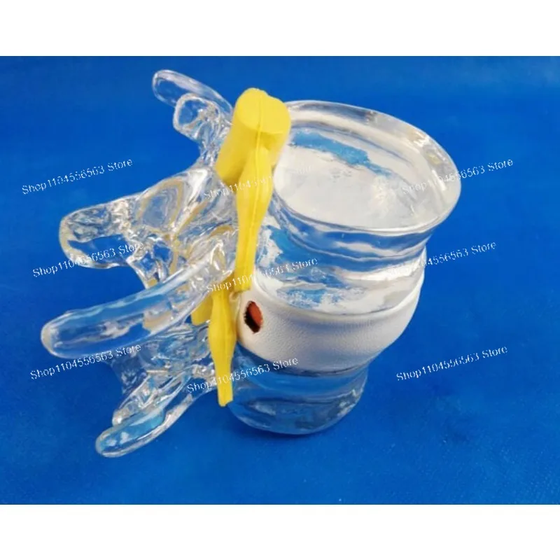 فتق القرص بثق العمود الفقري والعمود الفقري ، نموذج عرض القرص القطني ، نموذج العمود الفقري القطني منتج جديد #3