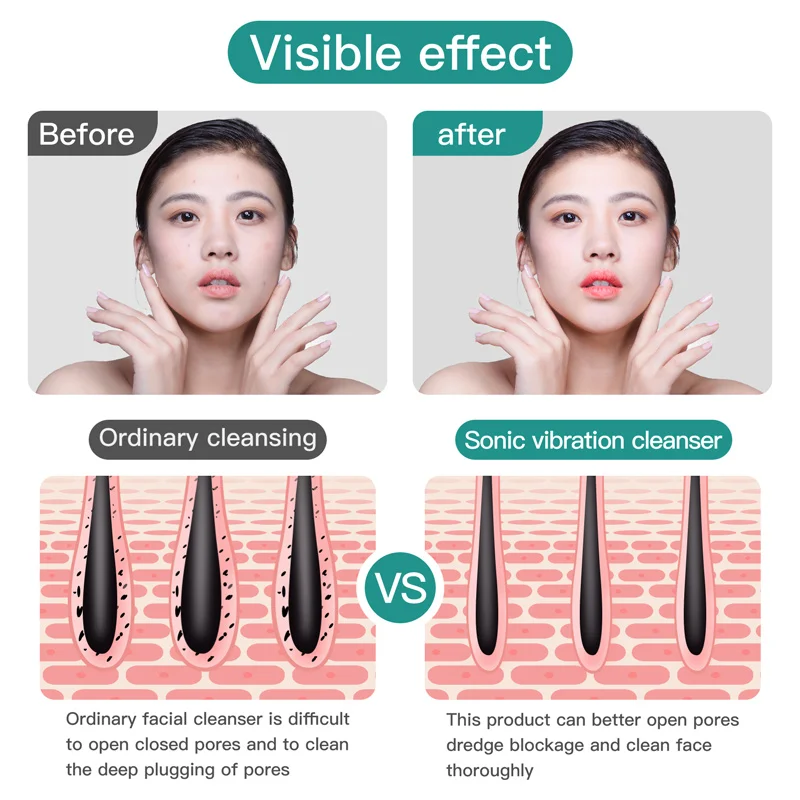 منظف الوجه الكهربائي الذي يعمل بالبطارية، فرشاة تنظيف الوجه بالاهتزاز المقاومة للماء بسرعتين، جهاز تدليك الوجه العميق #2