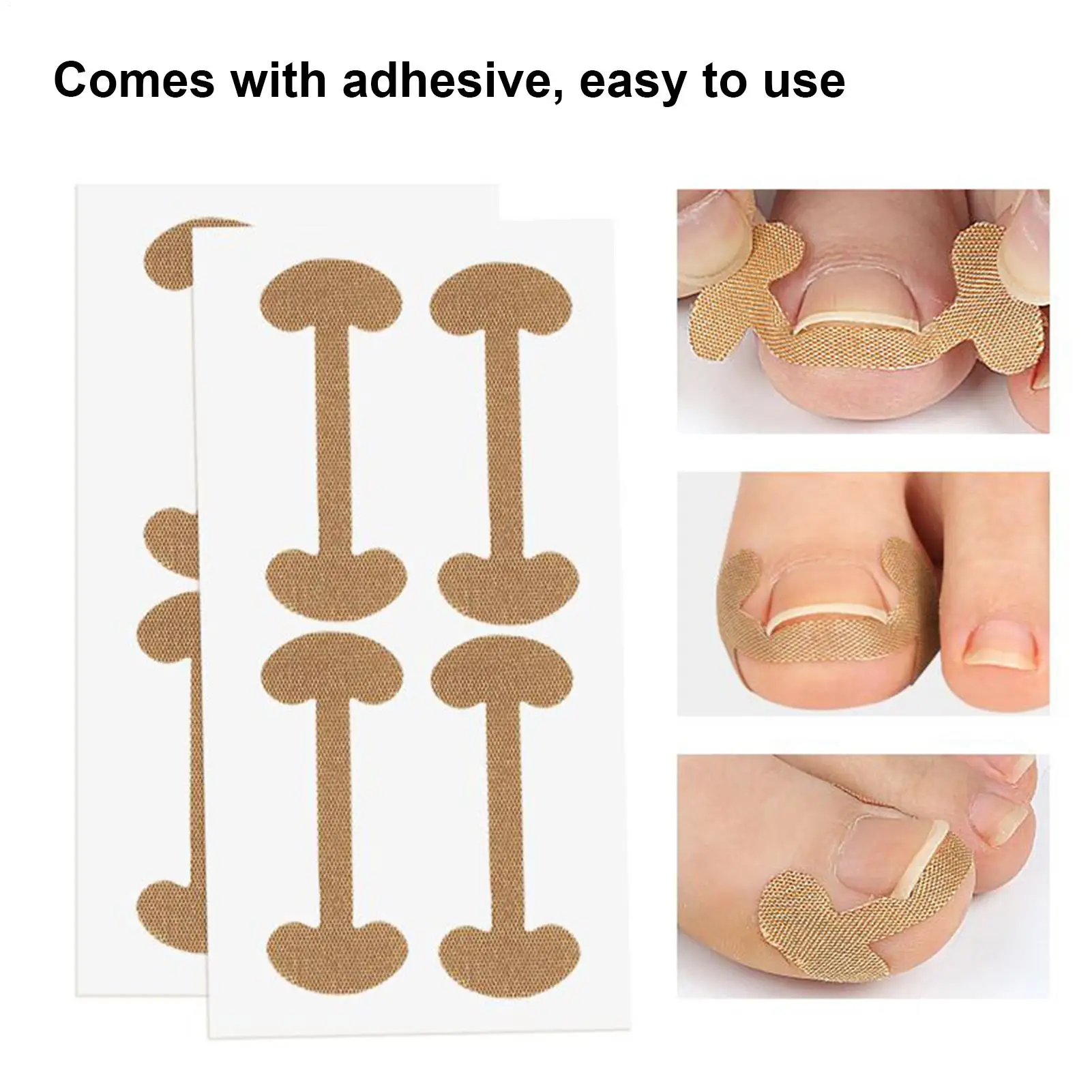 مجموعة أدوات أظافر نام نام تصحيح أظافر القدم التصحيح ملصقات مصحح باديكير أداة نام تو علاج الأظافر العناية بالقدم