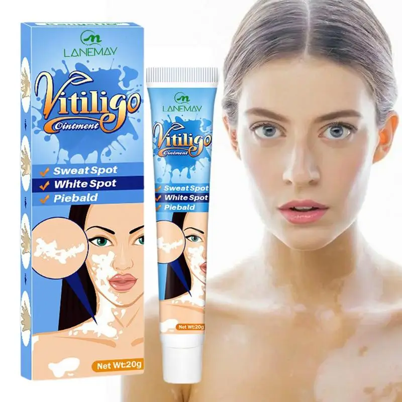 

0.7oz Herbal Extract Effectively Remove Vitiligo Ointment Leukoplakia Diseases Safe Cream Reduce Melanin Deposits Repair Skin