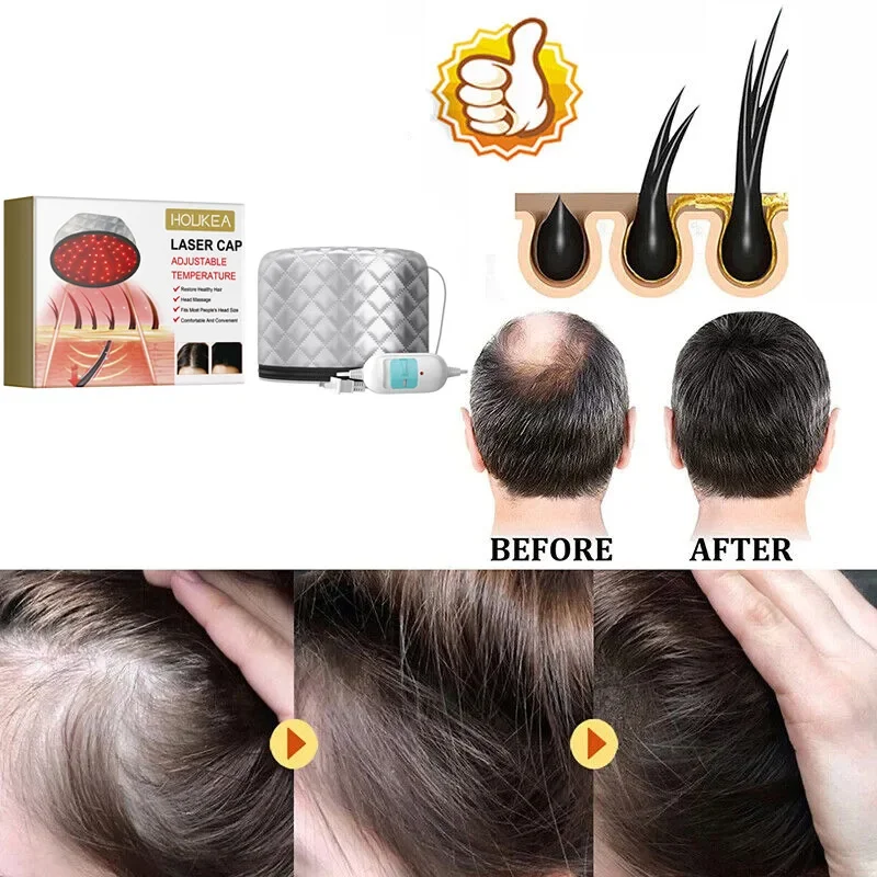 Hair Care Heating Cap,Anti Hair Loss Head Scalp Massage Hat Repair Dry Damaged Frizzy Bifurcate Hair,Increase Luster