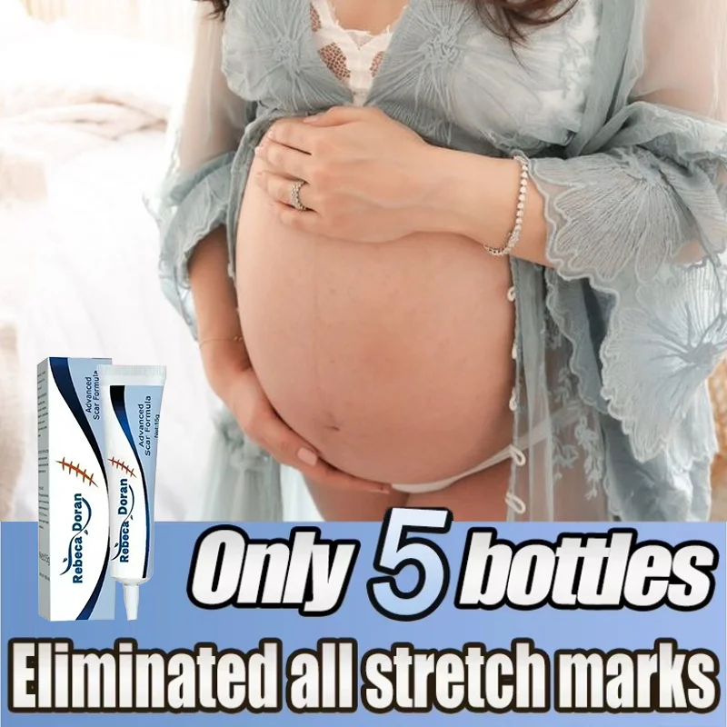 3RD Stretch Marks Remover Cream Pregnancy Maternity Body Ne Old Stretch Remove Marks Lifting Firming Increase Elasticity Of Skin