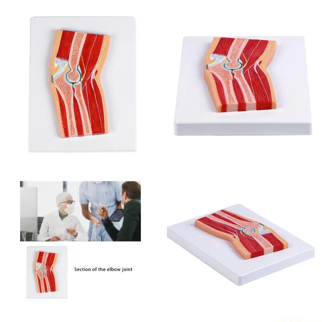 

Образовательная модель анатомии локтевого сустава ПВХ для образования и клинических условий