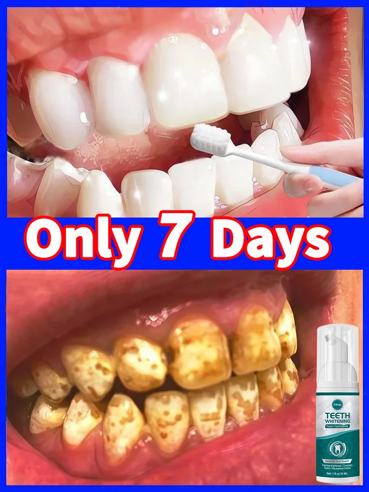 

Tartar removers dissolve tartar and remove stains 100% natural