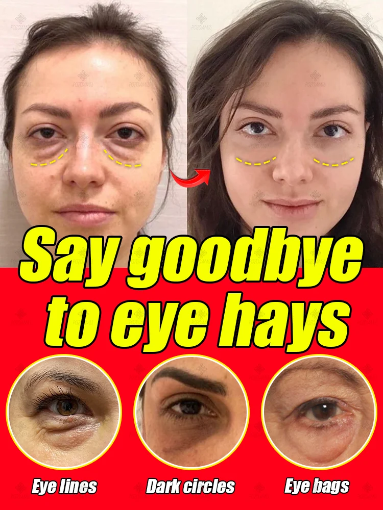 

Instantly Remove Eye Bags & Circles: Eye Cream to Reduce Fine Lines, Tighten Skin, and Fight Dark Bags for Smooth, Youthful Eyes