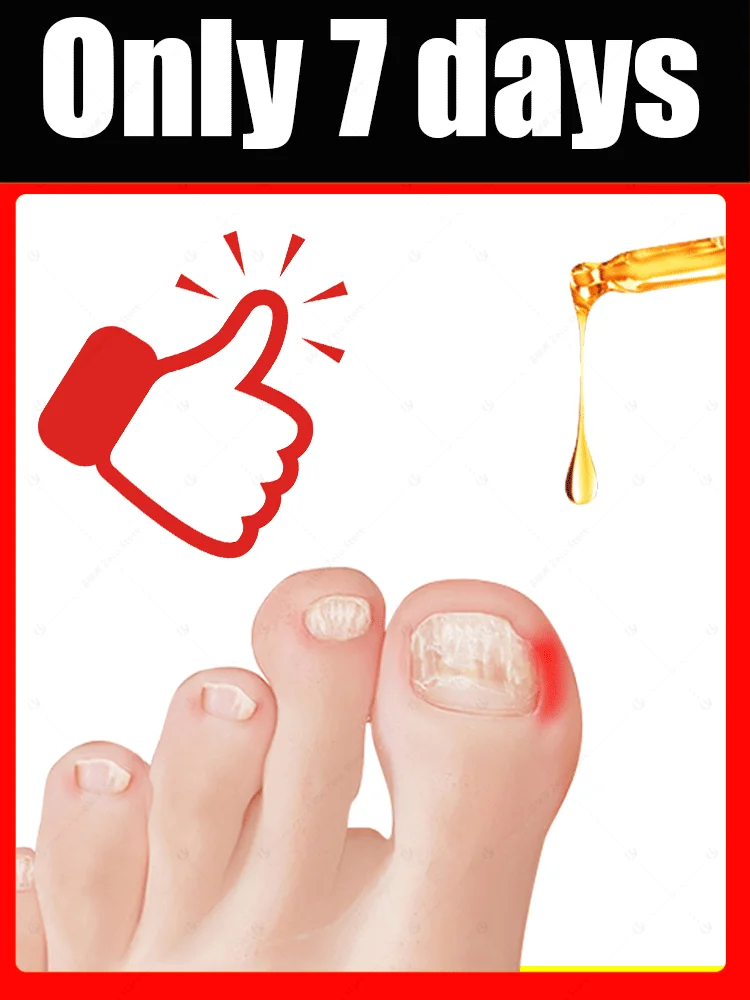 

manicure for bad Can in 7 days farewell